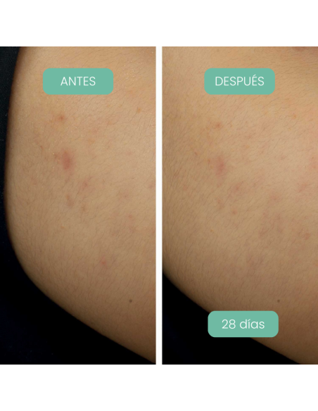 Piel con manchas visiblemente reducidas después de usar Crema noche antimanchas Alga-Biotic Laboratoires de Biarritz